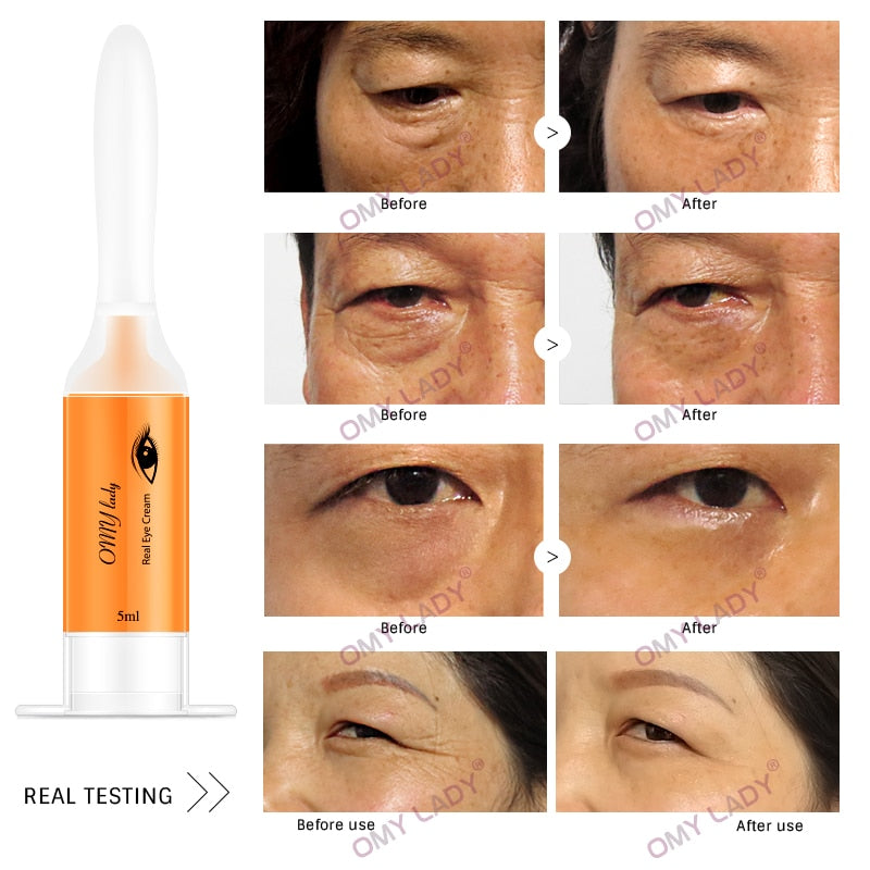 10PCS OMY LADY EyeCream Instant Remove Eyebags Firming Eye Anti Puffiness Dark Circles Under Eye Anti Wrinkle Anti Age Eye Care