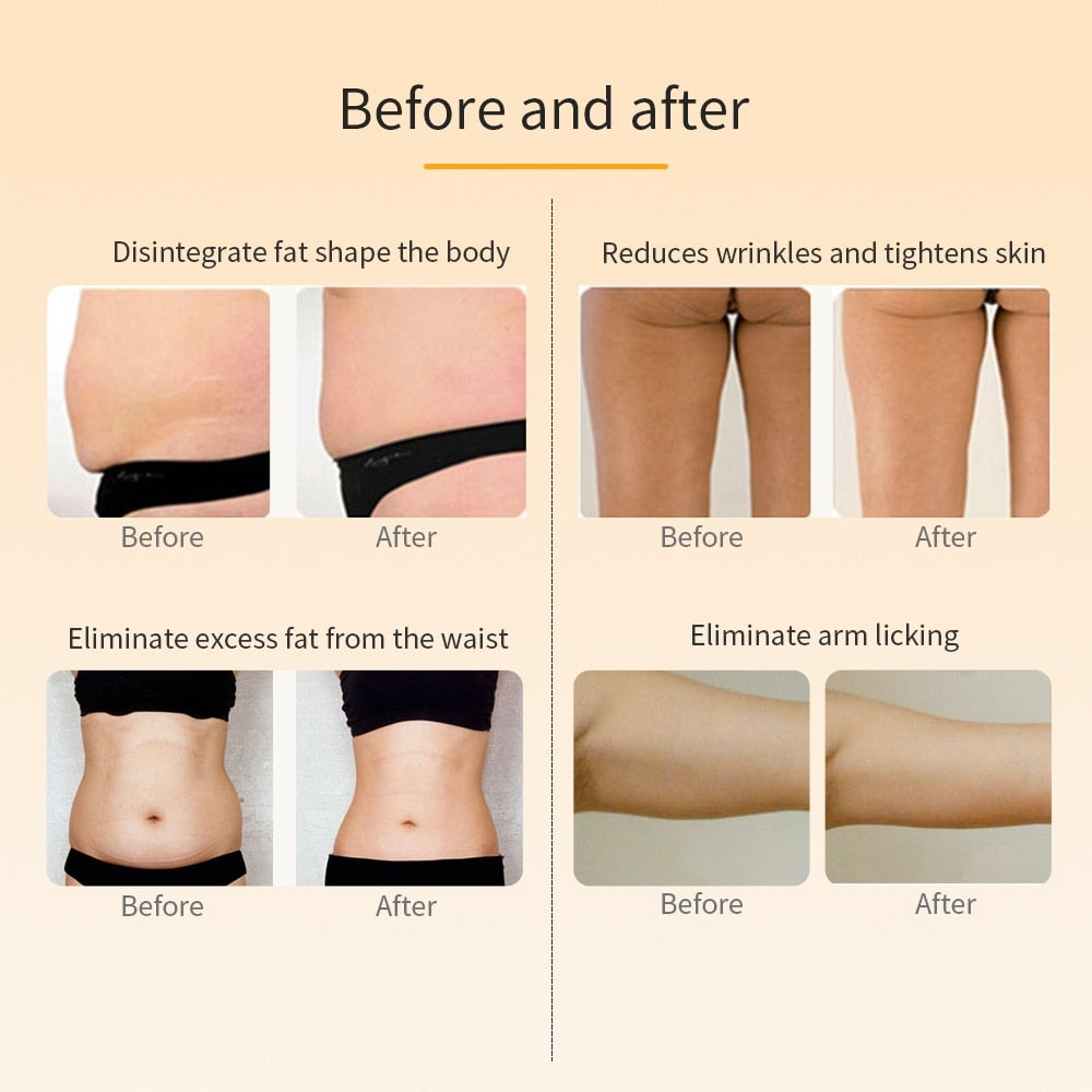RF Ultrasound Cavitation Fat Burner Weight Loss Body Shaping Slimming Firming Device LED Photon Rejuvenation Face Lift Massager.