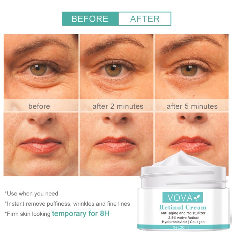 Instant Remove Wrinkles Retinol Face Cream Lifting Anti Aging Anti Eye Bags Moisturizer Facial Treatment Korean Care