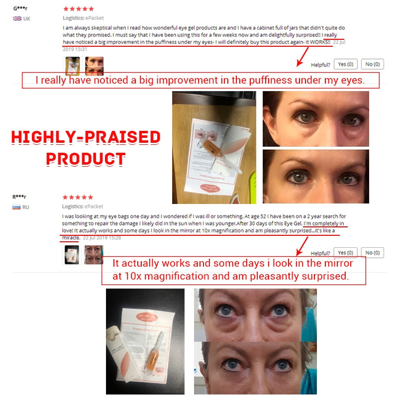 10PCS OMY LADY EyeCream Instant Remove Eyebags Firming Eye Anti Puffiness Dark Circles Under Eye Anti Wrinkle Anti Age Eye Care