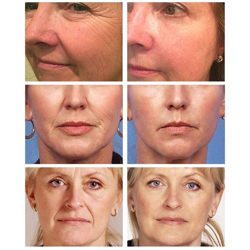 20g Firming Lifting Retinol Face Cream Anti-Aging Remove Wrinkles Fine Lines Whitening Brightening Moisturizing Facial Skin Care