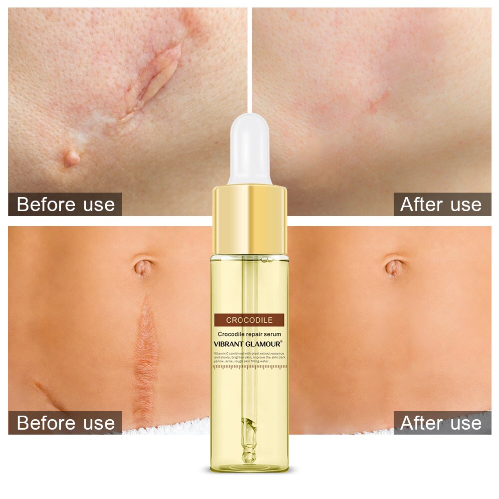 VIBRANT GLAMOUR Serum Set Hyaluronic Acid Collagen Peptides Face Serum Anti-wrinkle Shrink Pore Anti-Acne Moisturizing Skin Care