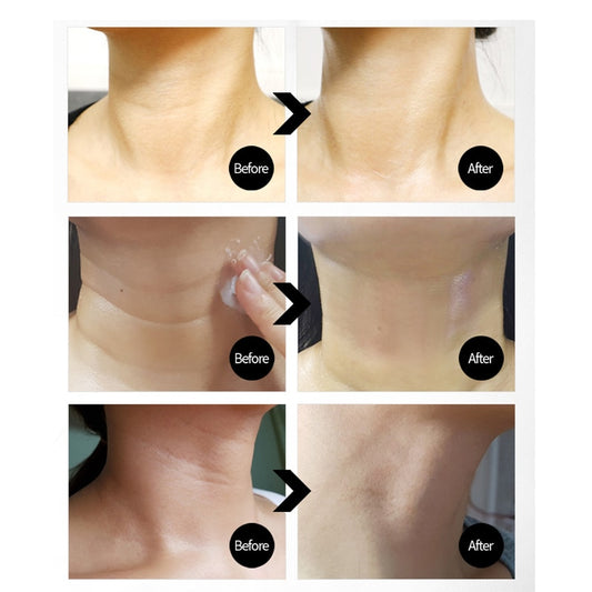 REAL Korea hydrolyzed collagen peptides for face Peptide Thread Neck Cream anti wrinkle anti aging whitening skin 5% adenosine