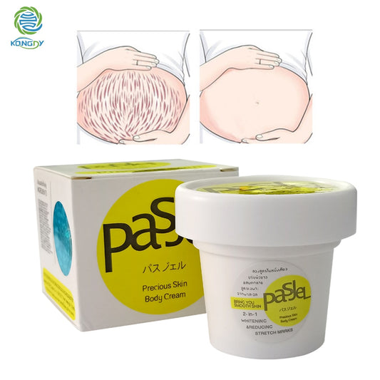 KONGDY Stretch Marks Cream Removal Obesity Pregnancy Scar Health Care Plant ingredients Cream Stretch Marks Repair Cream