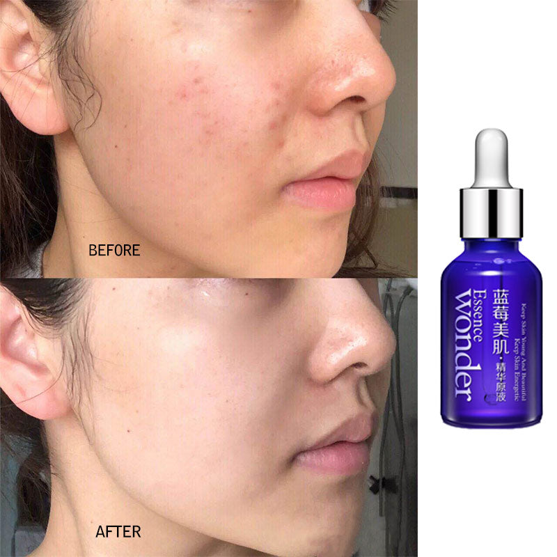 Bioaqua Blueberry Hyaluronic Acid Liquid & Eye Cream Anti-Puffiness Dark Circle Anti-Wrinkles Collagen Essence Whitening Skin