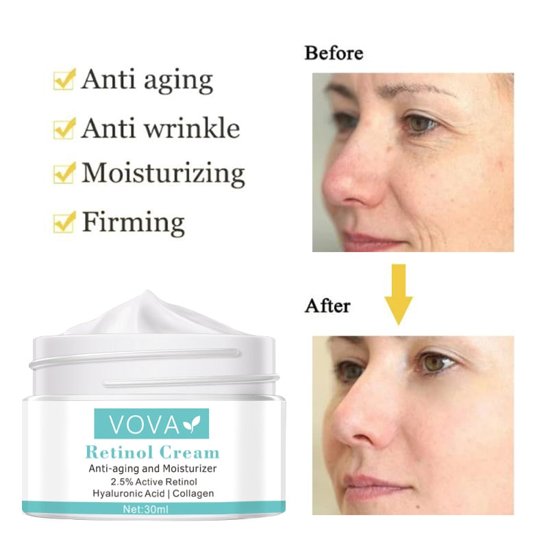 Instant Remove Wrinkles Retinol Face Cream Lifting Anti Aging Anti Eye Bags Moisturizer Facial Treatment Korean Care