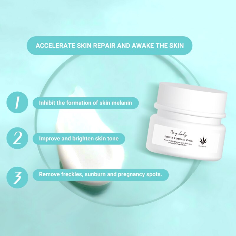 OMY LADY Freckle Removal Cream Remove Freckle Pregnant Spots Melanin Dark Spot Anti Aging Whitening Facial Cream Brightening