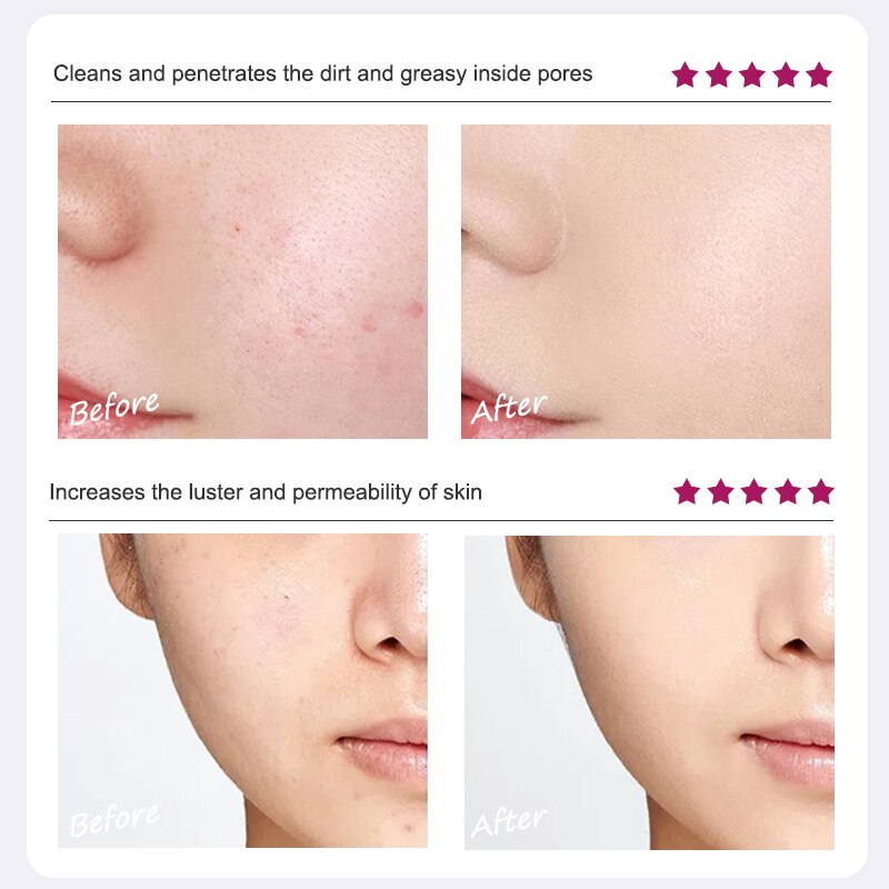 Skin Care Anti Winkles Anti Aging Olive Emulsion Hyaluronic Acid Serum Face Care Anti-aging Serum Ance Treatment Essence