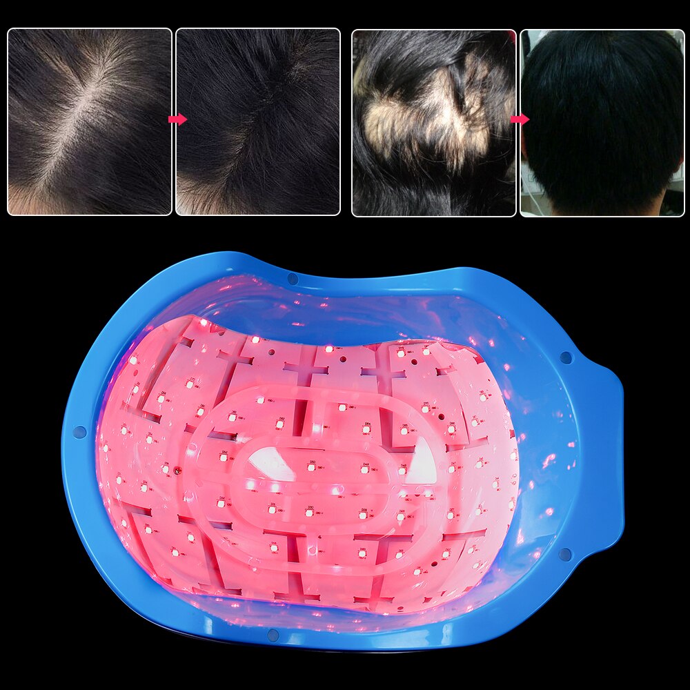 678nm Laser Therapy Hair Growth Helmet Anti Hair Loss Device Treatment Anti Hair Loss Promote Hair Regrowth Cap Massage