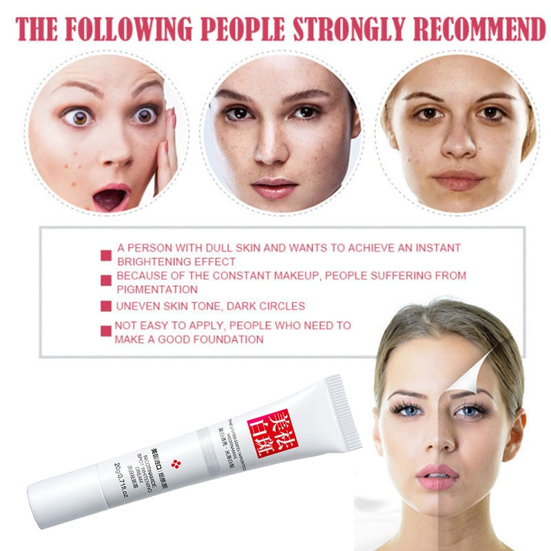 Whitening Face Cream Retinol Freckles Cream Age Spots Skin Whitening Strong Effect Dark Spots Melasma Lightening Lip Face Cream.
