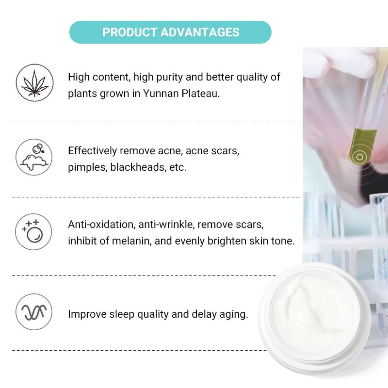 OMY LADY Freckle Removal Cream Remove Freckle Pregnant Spots Melanin Dark Spot Anti Aging Whitening Facial Cream Brightening