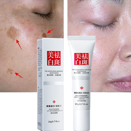 Whitening Face Cream Retinol Freckles Cream Age Spots Skin Whitening Strong Effect Dark Spots Melasma Lightening Lip Face Cream.