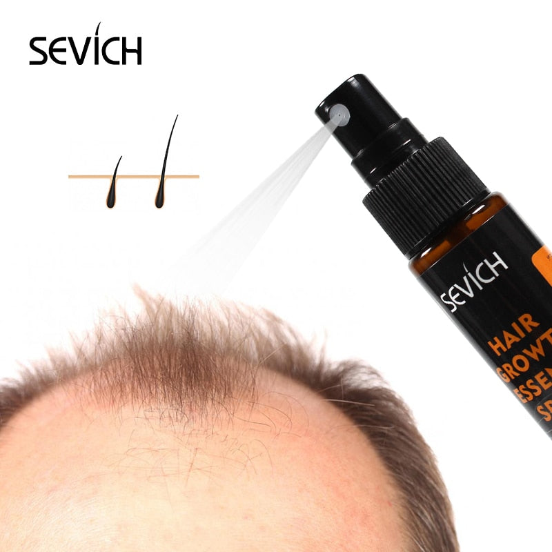Sevich Ginger Fast Hair Growth Spray Anti Preventing Hair Loss Liquid Damaged Hair Repair Growing Spray Anti-Loss Hair Treatment