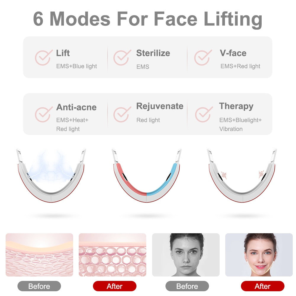 AmazeFan EMS Facial Lifting Device Double Chin Remove Chin Face Firming LED Photon Therapy Cheek Lift Up Belt Beauty Device.