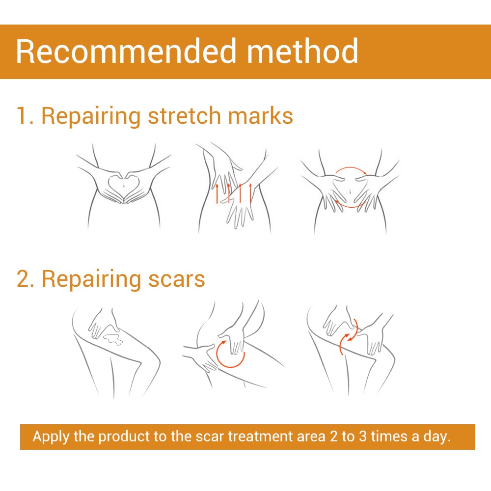 LANBENA Stretch Mark Remover Skin Care Scar Cream From Stretch Marks Maternity Treatment Repair Skin Care Body Cream Bio Oil