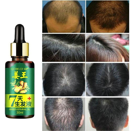 7 Day Ginger Germinal Serum Essence Oil Loss Treatement Growth Hair 30ML Healthy Hair Growth Essence Oil.