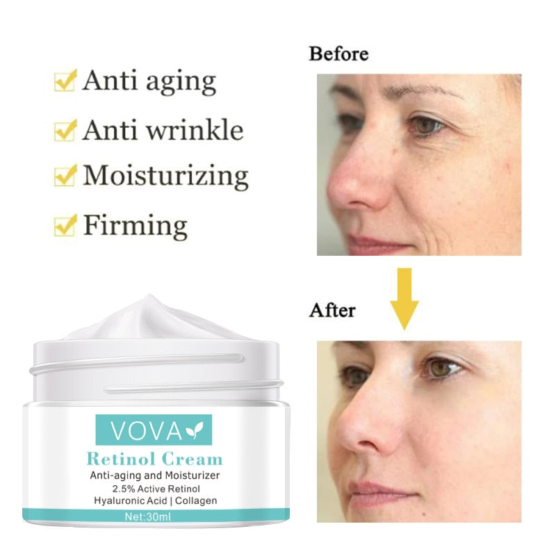 VOVA Retinol Anti Wrinkle Face Cream Collagen Hyaluronic Acid Shrink Pores Firming Improve Puffiness Moisturizing Skin Care