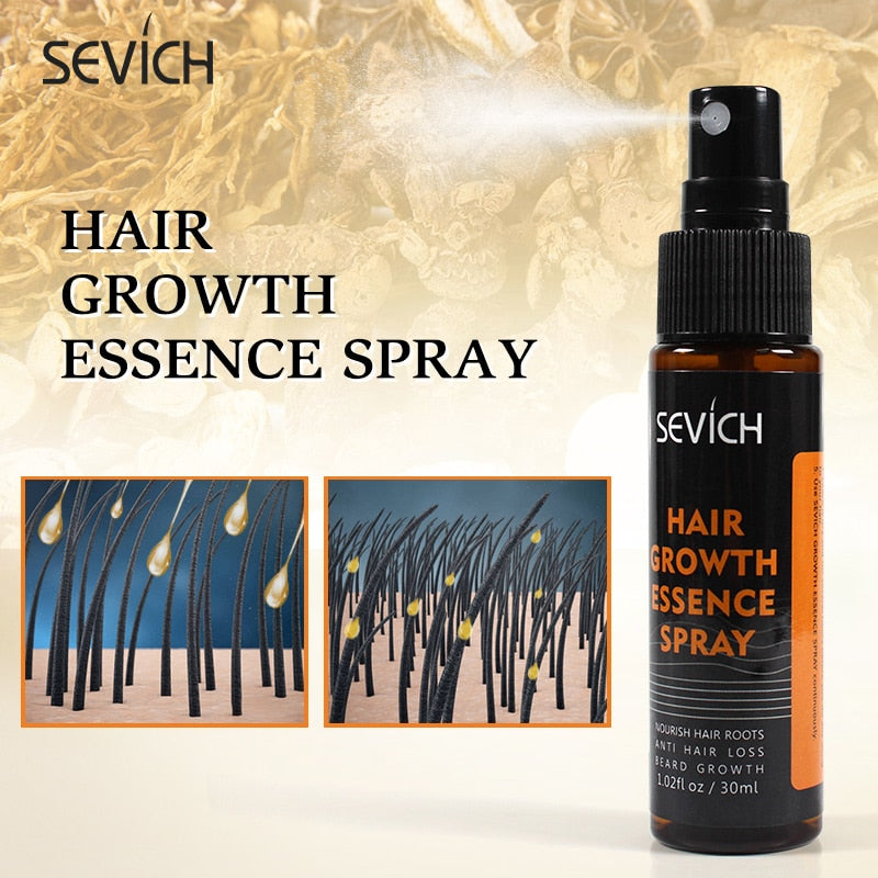 Sevich Ginger Fast Hair Growth Spray Anti Preventing Hair Loss Liquid Damaged Hair Repair Growing Spray Anti-Loss Hair Treatment