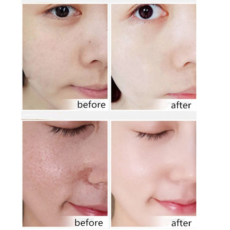 Dr.Sugarm 4D Hyaluronic Acid Serum  Face Moisturizing Solution Whitening Anti Aging Anti Wrinkle Acne Facial Essence