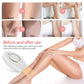 Electric Epilator For Women&#39;s Shaver Permanent IPL Hair Removal 600000 Flash Hair Removal Photoepilator Painless Home Use Device.